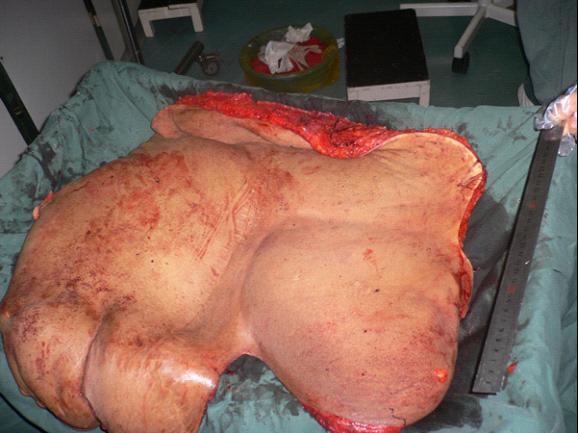 台州市博爱医院|路桥博爱医院