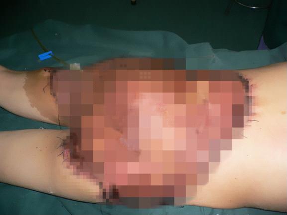 台州市博爱医院|路桥博爱医院