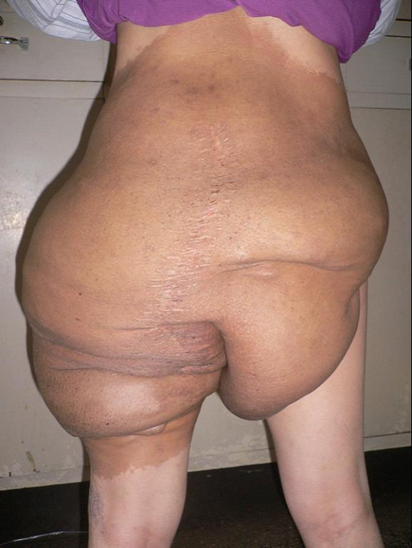 台州市博爱医院|路桥博爱医院