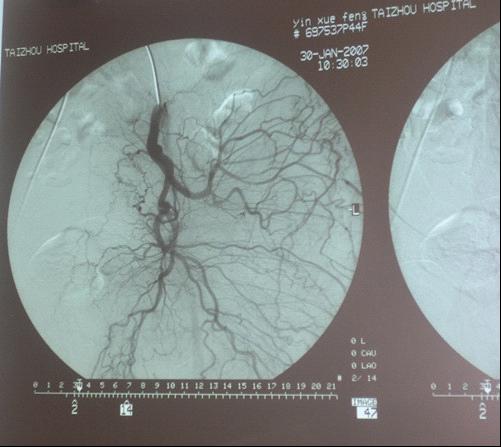 台州市博爱医院|路桥博爱医院