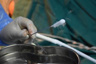 台州市博爱医院开展全市首例氩氦刀冷冻消融术|路桥博爱医院