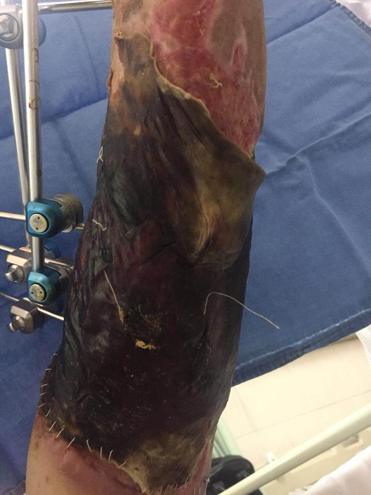 碰到这样的医疗团队 我真的很幸运|台州市博爱医院