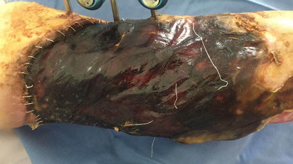 碰到这样的医疗团队 我真的很幸运|台州市博爱医院