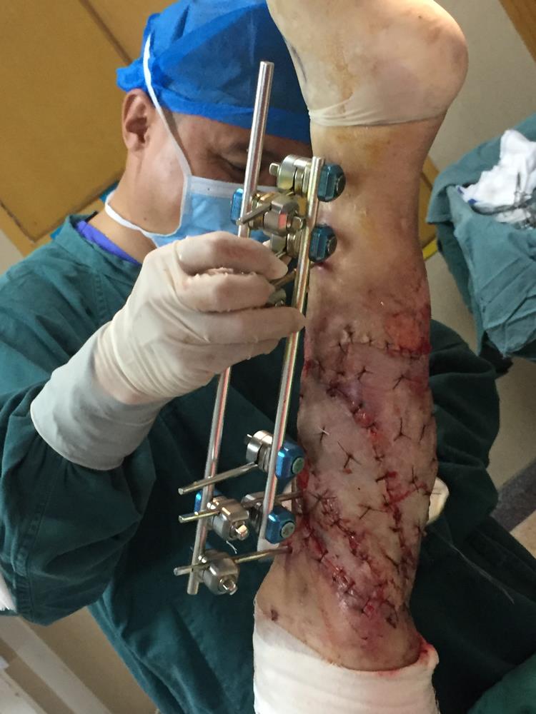 碰到这样的医疗团队 我真的很幸运|台州市博爱医院