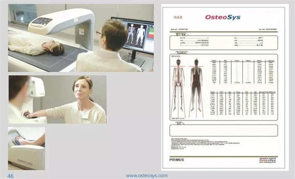 台州市博爱医院引进进口双能骨密度仪