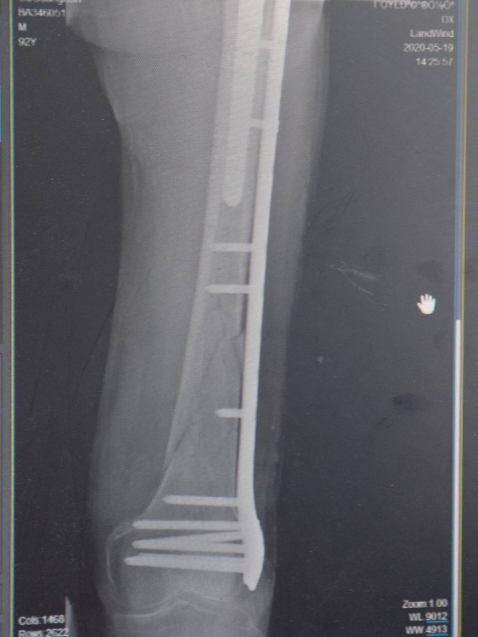 爱心，在无声的关心中绽放|台州市博爱医院