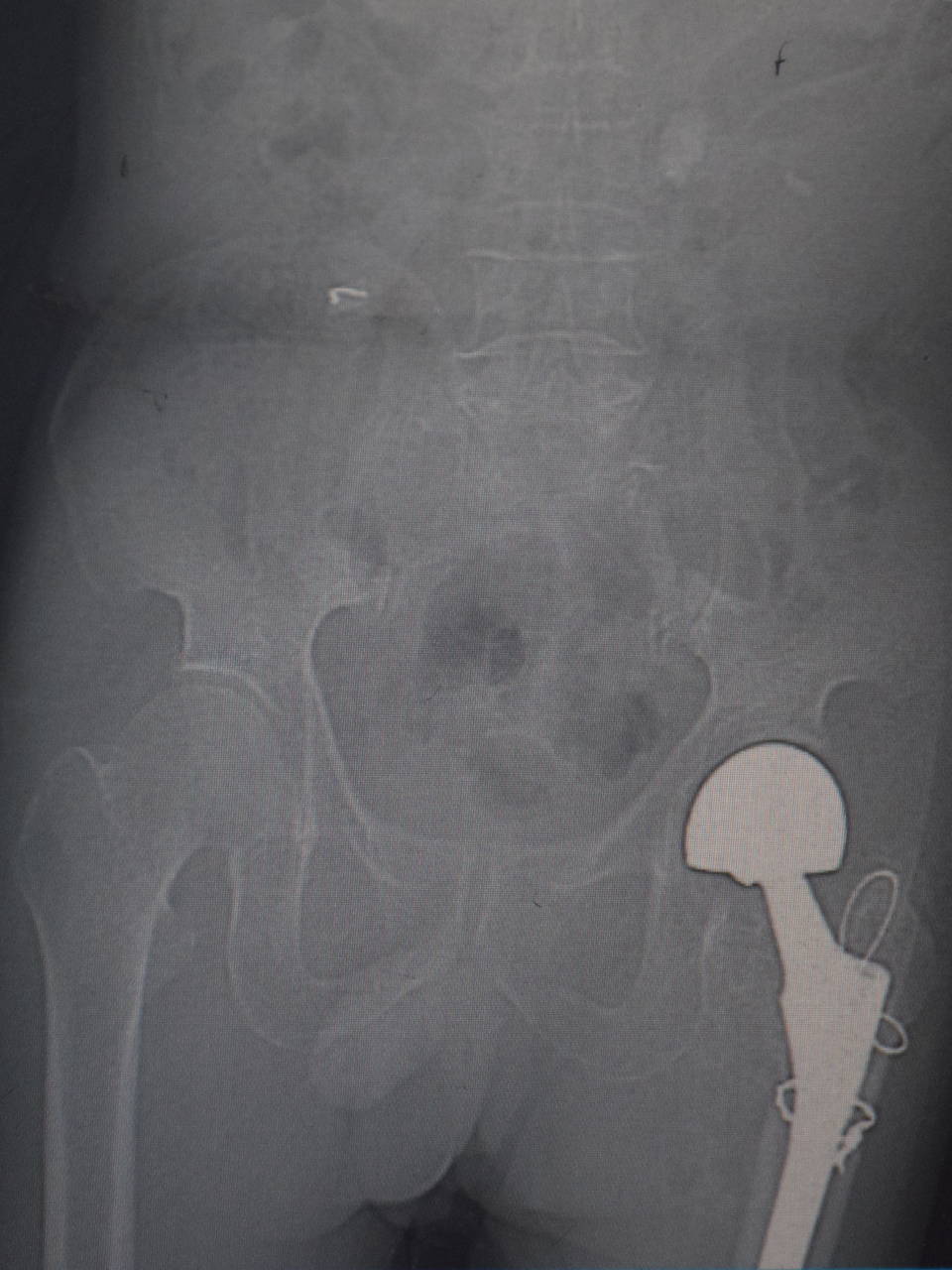 爱心，在无声的关心中绽放|台州市博爱医院