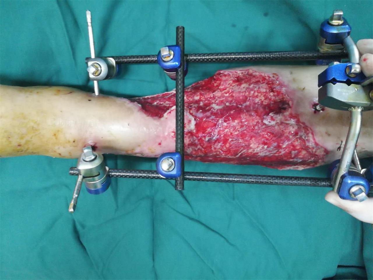 医生上门贴心“售后”，患者的举动令人泪目