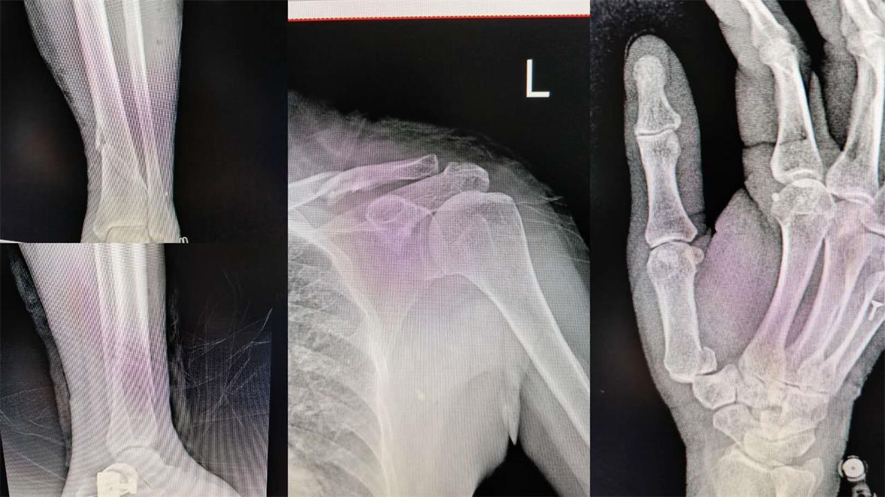 医生上门贴心“售后”，患者的举动令人泪目