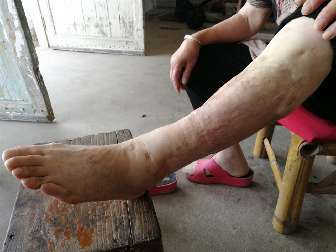 医生上门贴心“售后”，患者的举动令人泪目