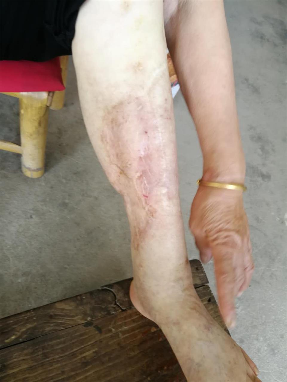 医生上门贴心“售后”，患者的举动令人泪目