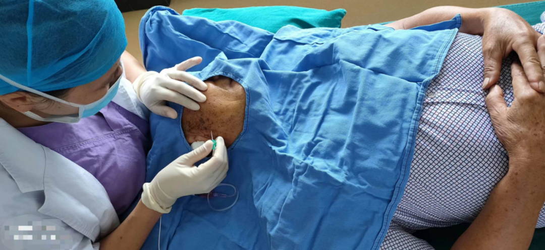 探秘丨三叉神经痛，最容易被误诊的“天下第一痛”