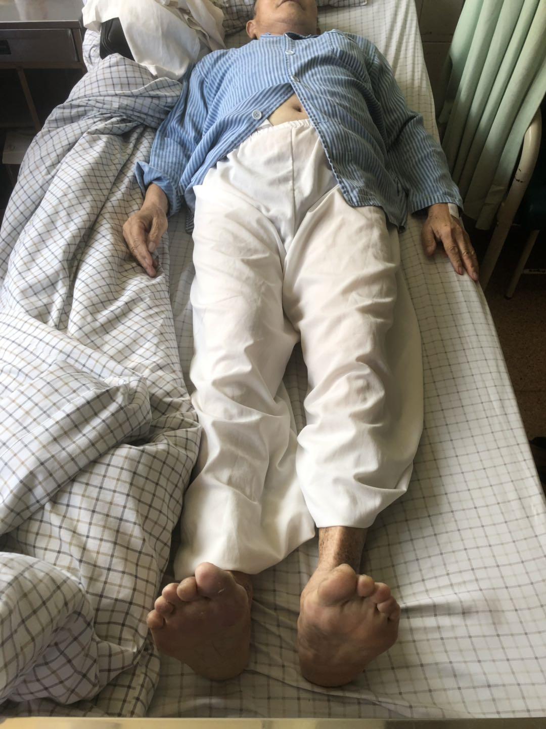 六十多年后，我终于找到了你——藏在腿里的秘密|台州市博爱医院