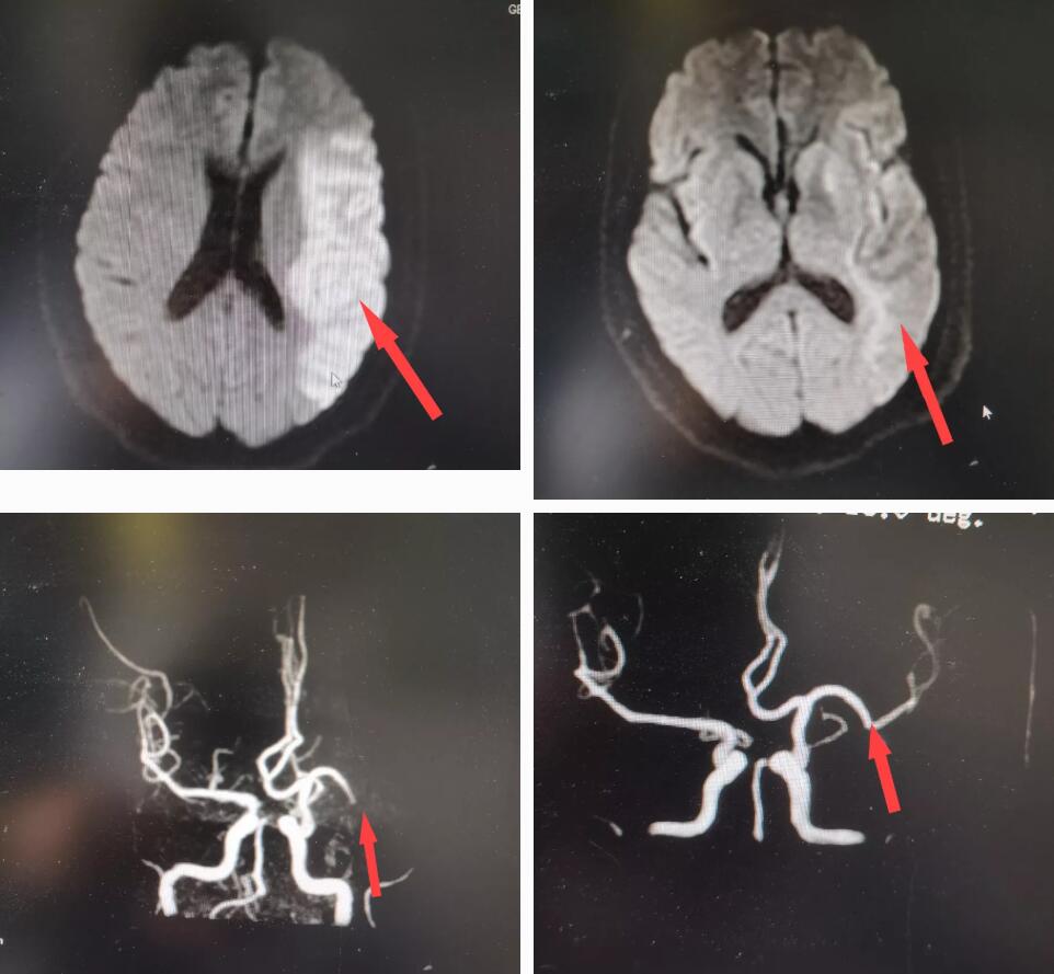 又聋又哑的他，把九病区当作第二个“家”|台州市博爱医院