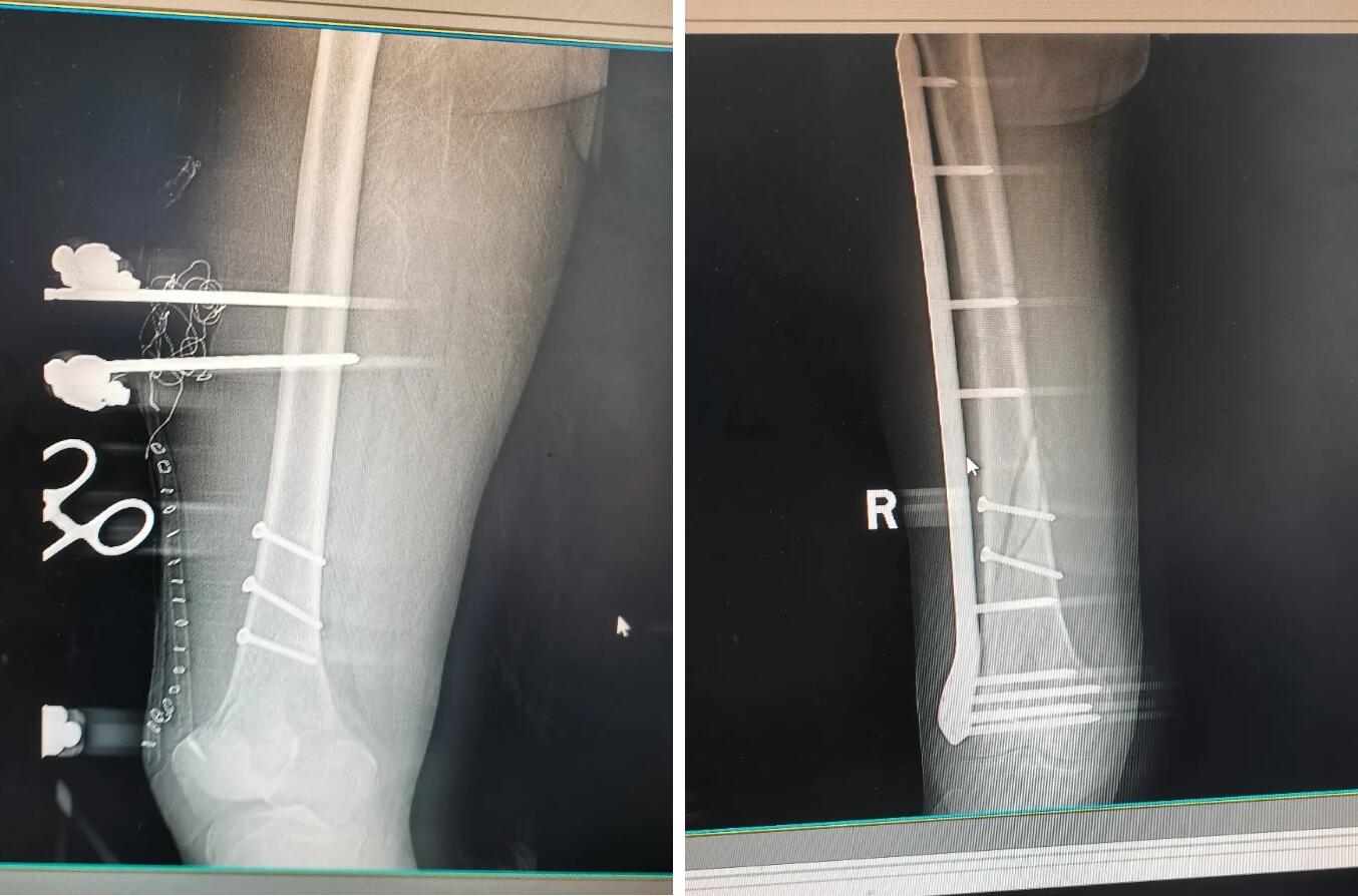 四面锦旗的背后——那些触动人心的温暖与感动|台州市博爱医院