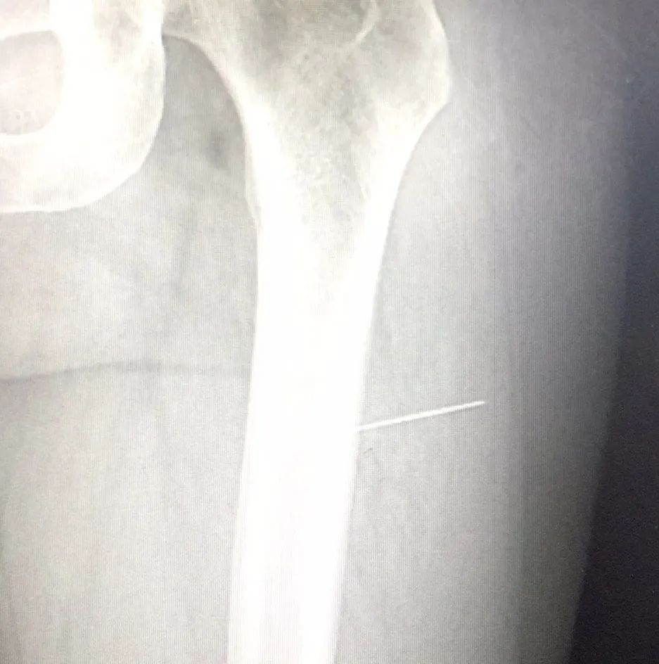 四面锦旗的背后——那些触动人心的温暖与感动|台州市博爱医院