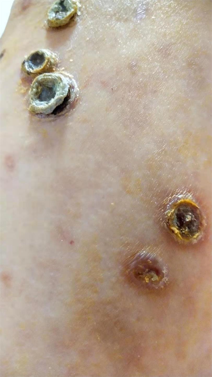 马赛克都遮不住的疤丨被疼痛科医生盯上的她，最后怎么样了？