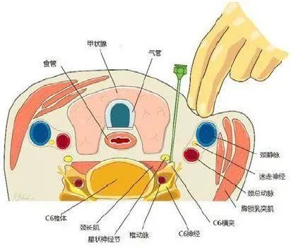 更年期让她“不想活了”，找医生扎了几次针后……