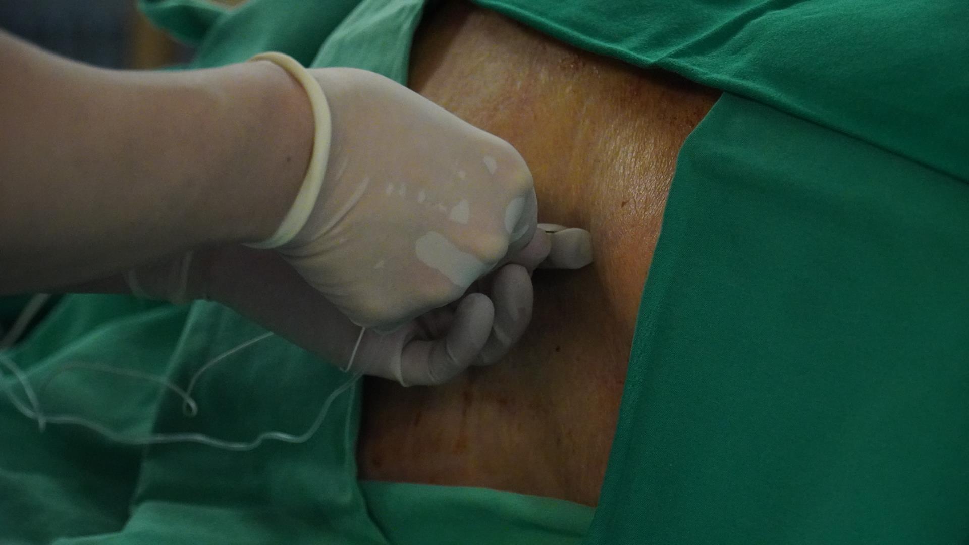 中国麻醉周｜全程守护生命，绝不是“打一针就走”|台州博爱医院