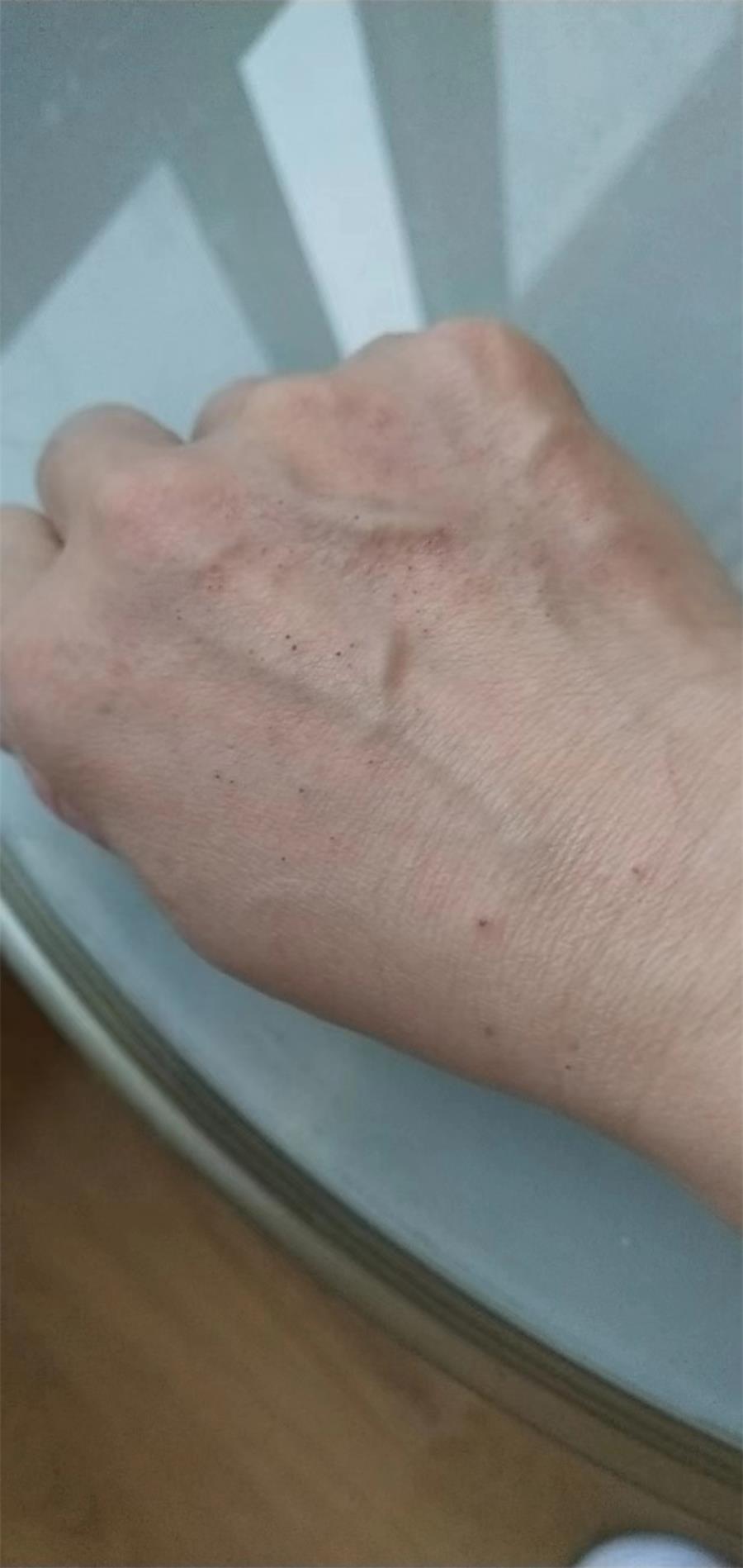 台州博爱医院医共体,支援金华